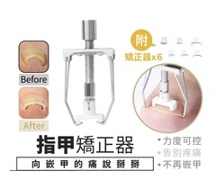指甲護理防內長矯正器